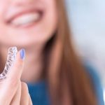 mascherine trasparenti invisalign